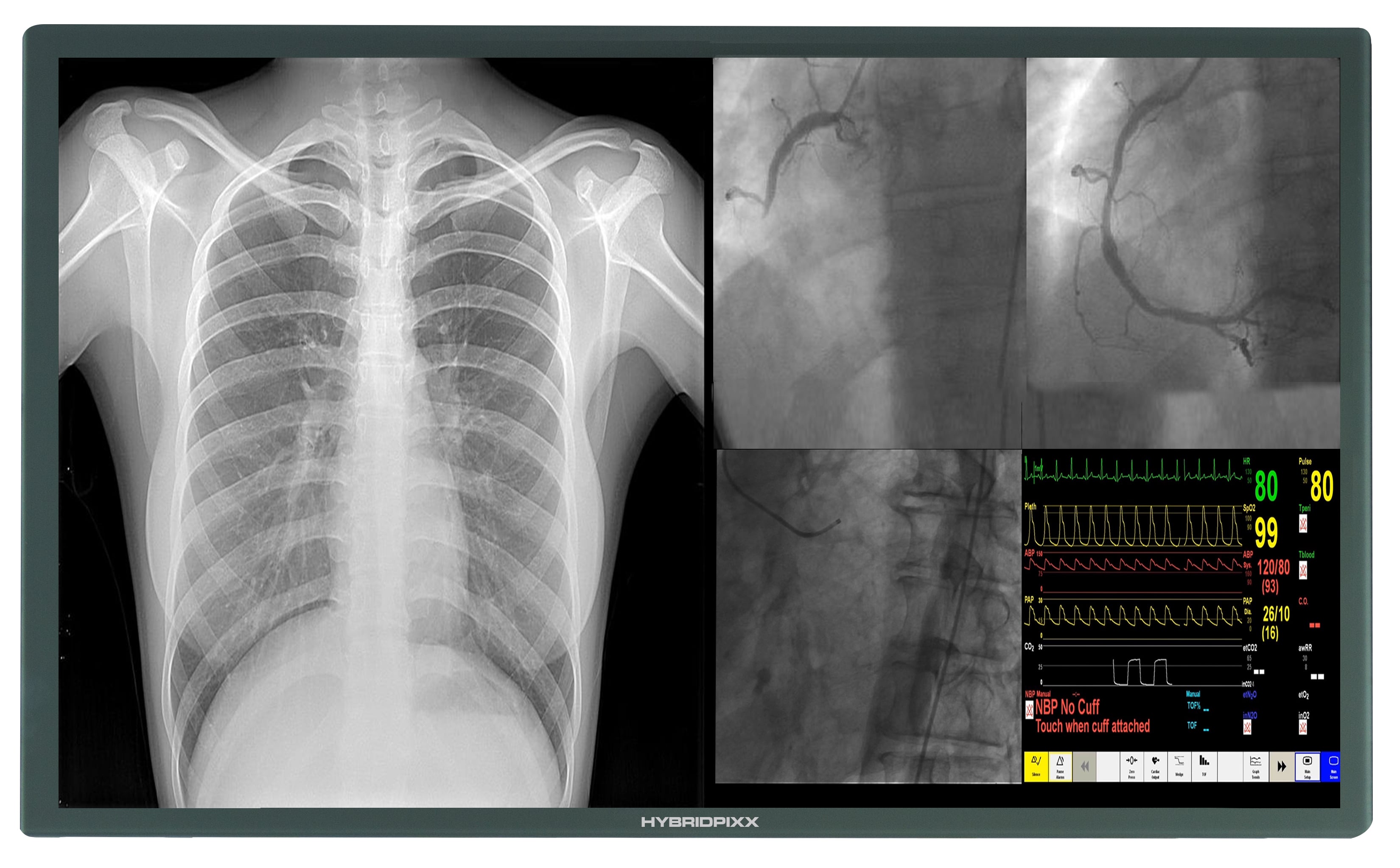 A Guide to Medical Display Technology: From Terminals to Imaging