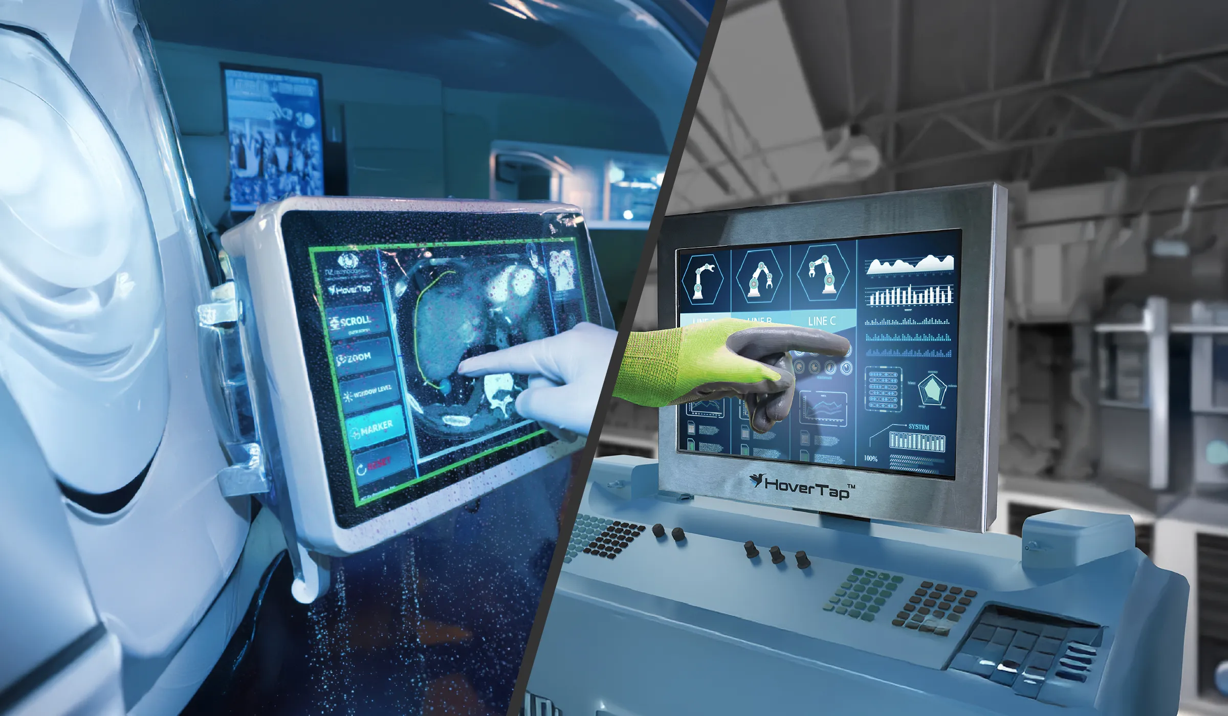 surgical-touch-screen-glove-operation